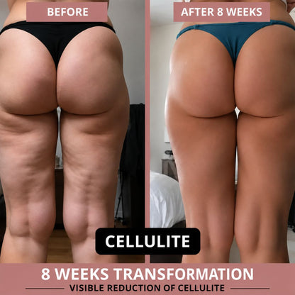 Sculpting Leggings for Weight Loss & Cellulite Reduction