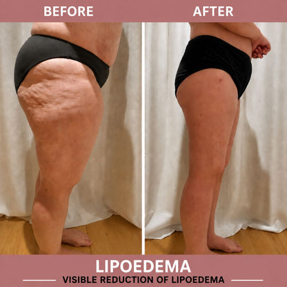 Sculpting Leggings for Weight Loss & Cellulite Reduction
